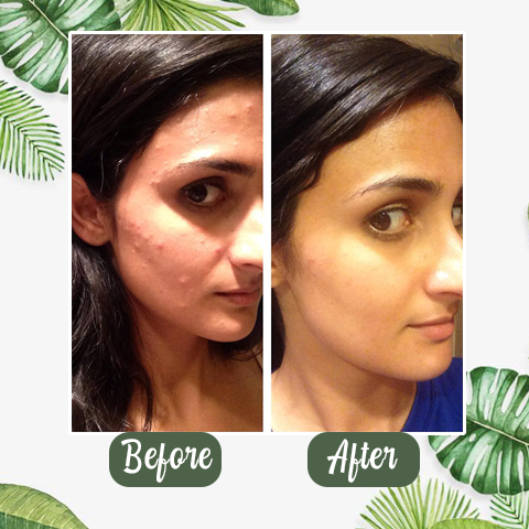 100% Natural Green Tea Deep Cleanse Mask