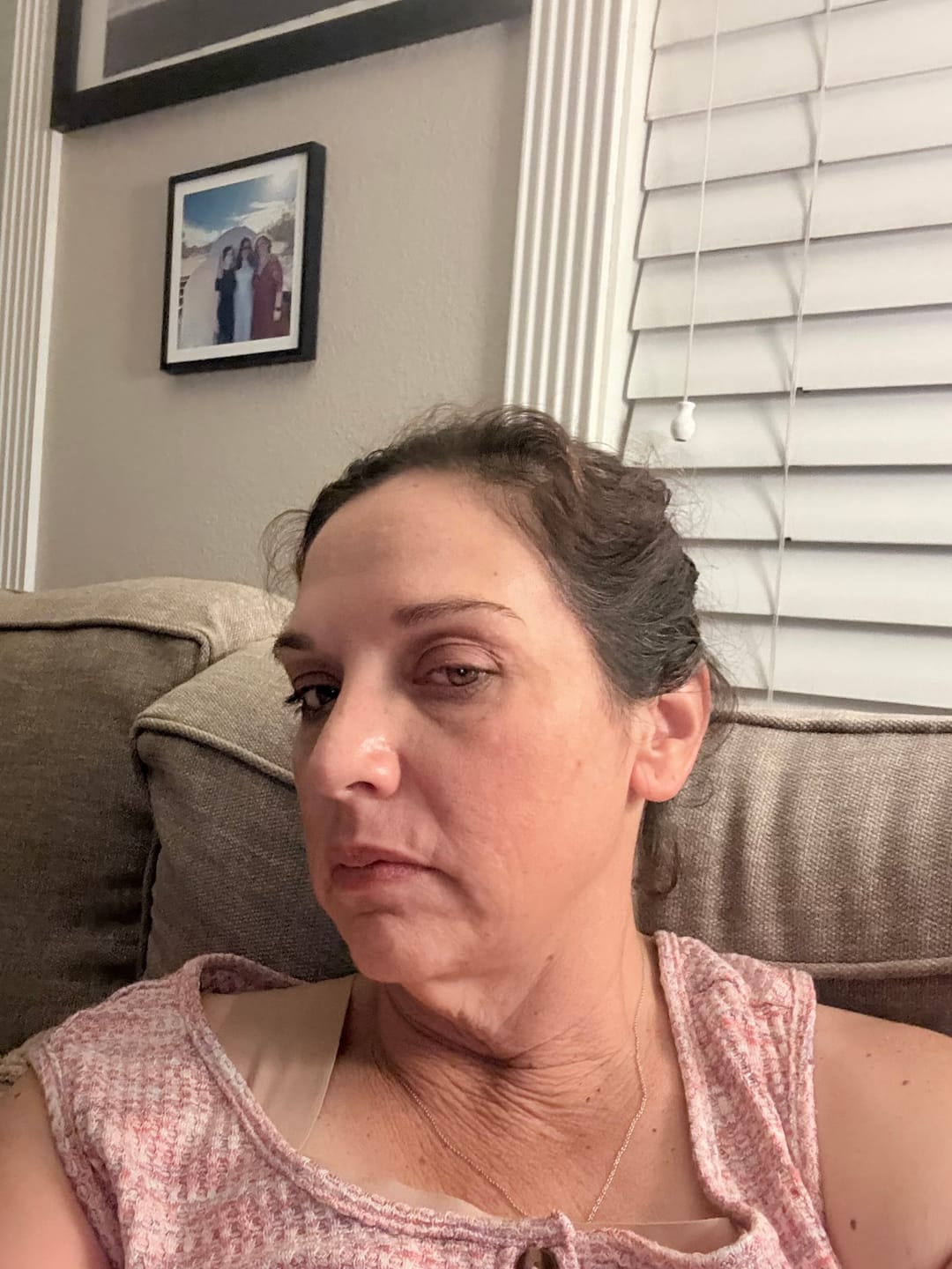 Customer photo review of The Complete System for Mature Women’s Skin