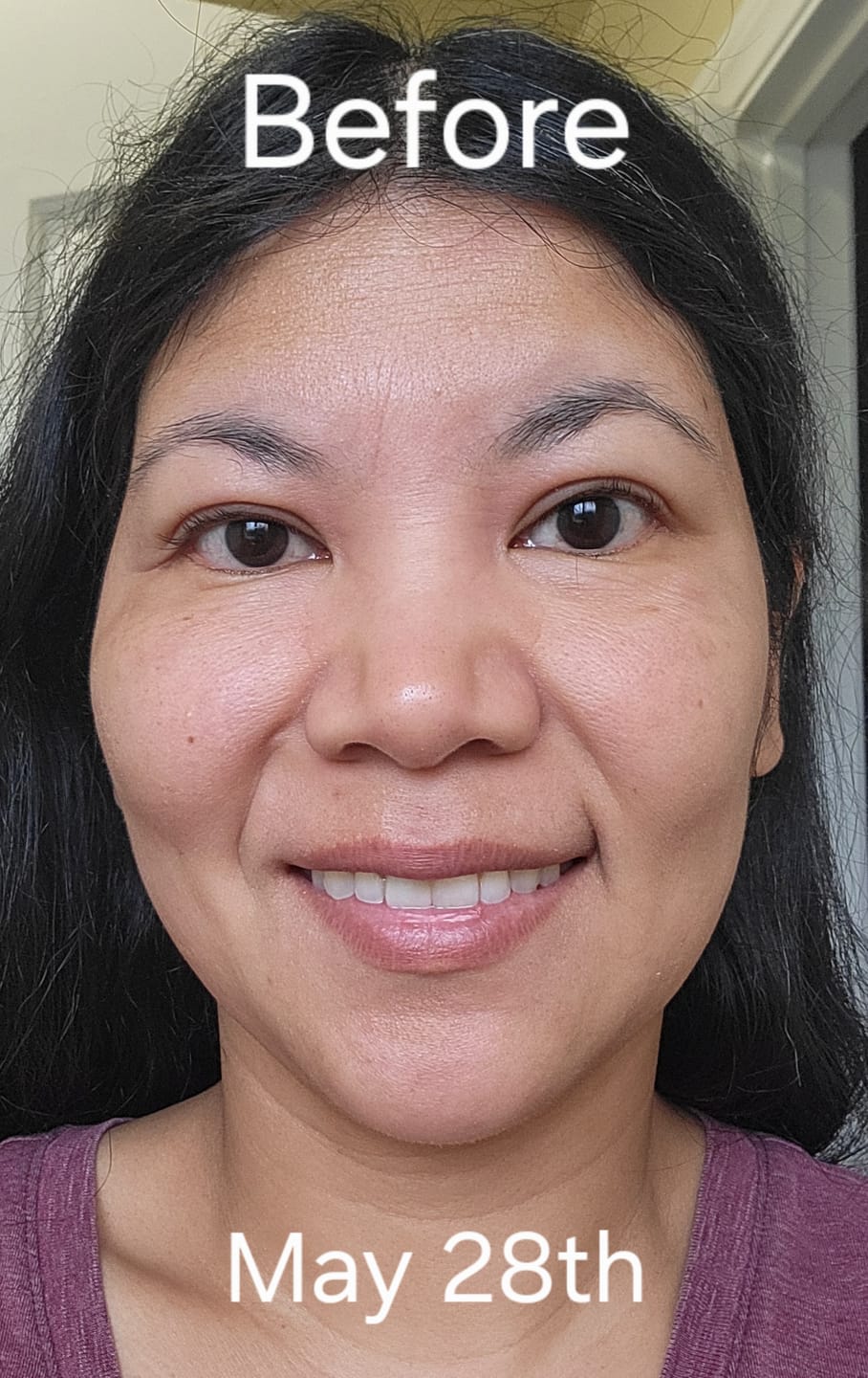 Customer photo review of The Complete System for Mature Women’s Skin